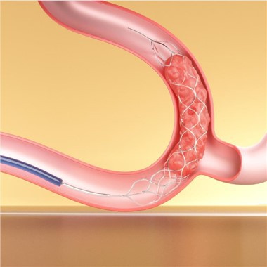 Устройства за тромбектомия Stent Retriever